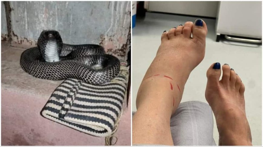 Snake Bites Bihar Woman; Family Smartly Brings Both Her And Reptile To Hospital For Easy Treatment